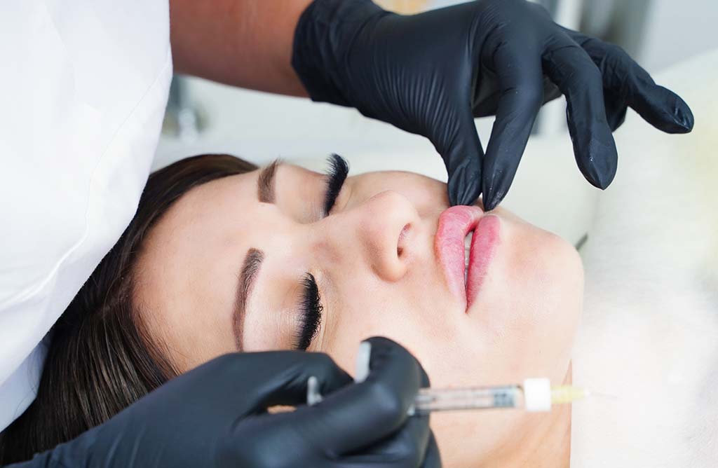 Honolulu upper lip (perioral) treatment using injectable fillers to increase lip volume at Hawaii Facial Plastic Surgery.