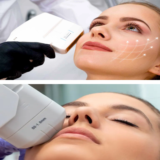 The primary benefit of Ultherapy in Honolulu, HI is to tighten and lift skin without a surgical facelift procedure.