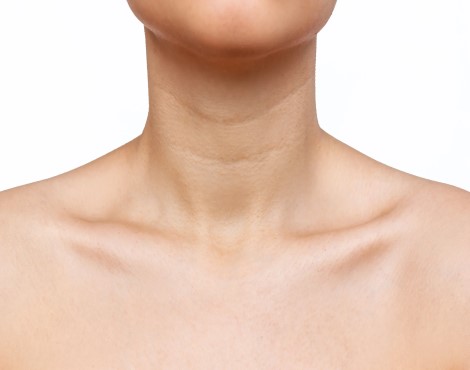 Oahu HIFU non-surgical treatments can be used on the upper chest below the neck or decolletage. Skin lifting, Honolulu.