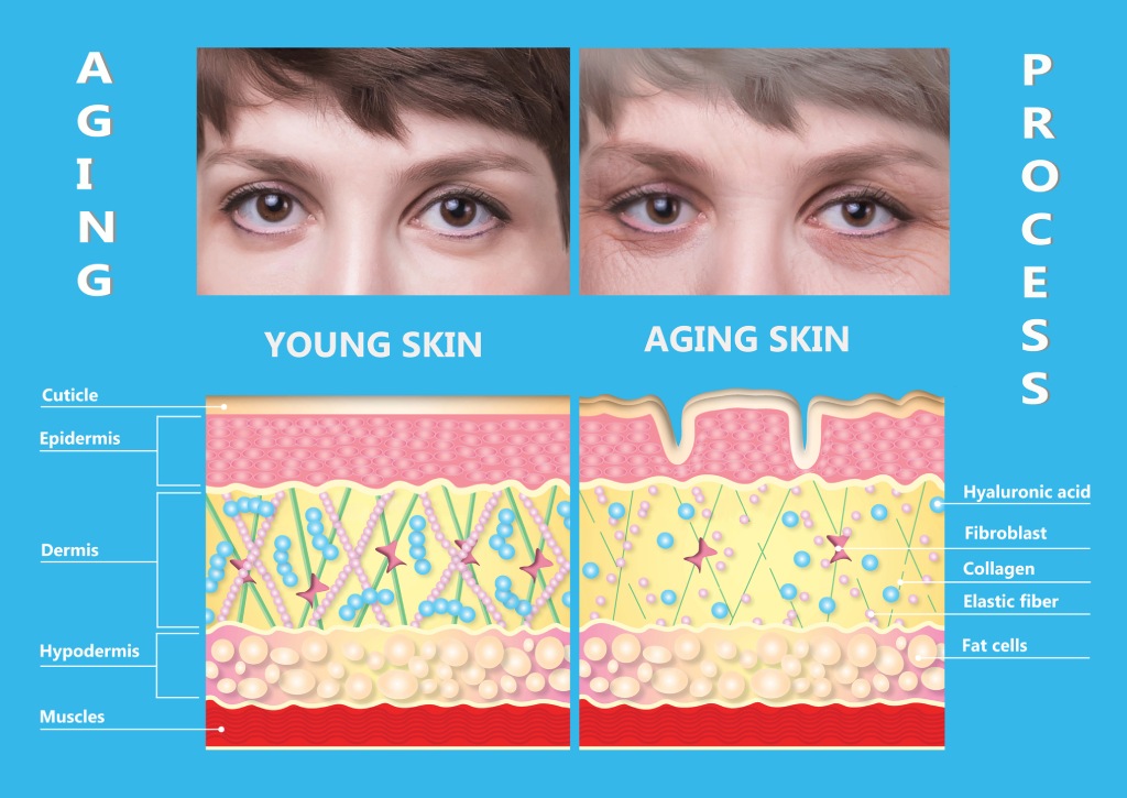 Aging process chart showing what causes collagen loss. Oahu treatments such as Botox, Sculptra, & RF microneedling can improve collagen growth.