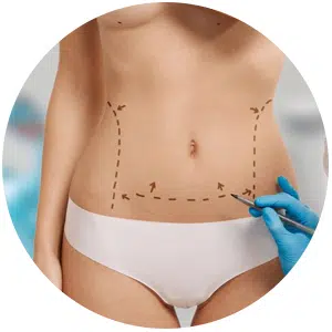 Oahu plastic surgery clinic, Honolulu, HI. Neck liposuction procedure.