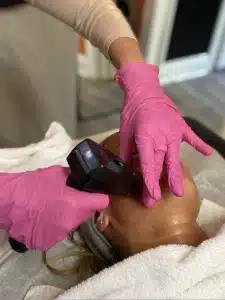 Advanced RF microneedling treatment, Morpheus8, Oahu, Hawaii. Morpheus8 treatment in Honolulu.