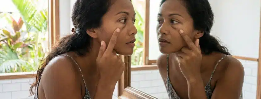 Honolulu resident with puffy eyes in Hawaii looks at her reflection in the mirror.