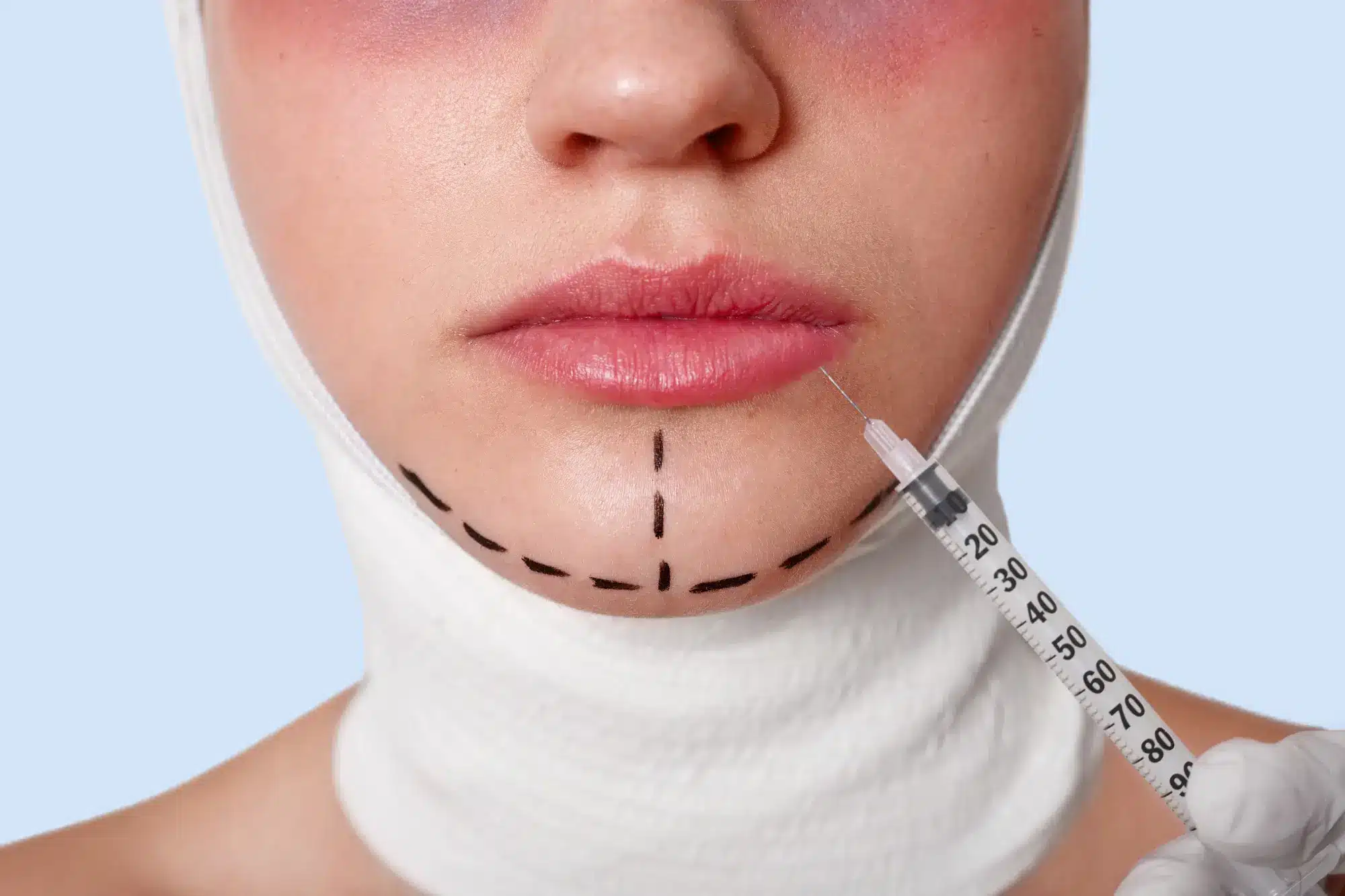Injectable filler in Hawaii used to restore volume, wrinkle reduction, and more.