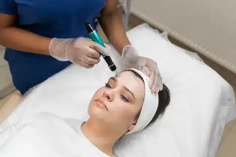 Honolulu SkinPen Microneedling treatment at Hawaii Facial Plastic Surgery. Treatment cost $250 between $250 and $400 per session